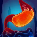 Gas Trouble in Stomach Acidity