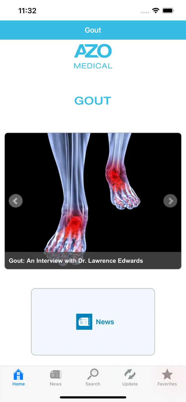 Gout by AZoMedical screenshot #1 for iPhone