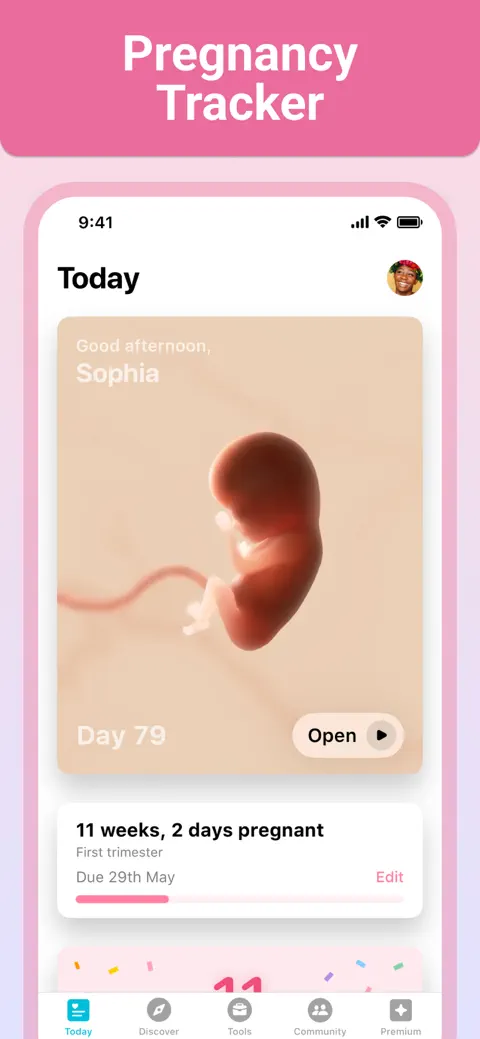 Pregnancy + | Tracker App screenshot 1